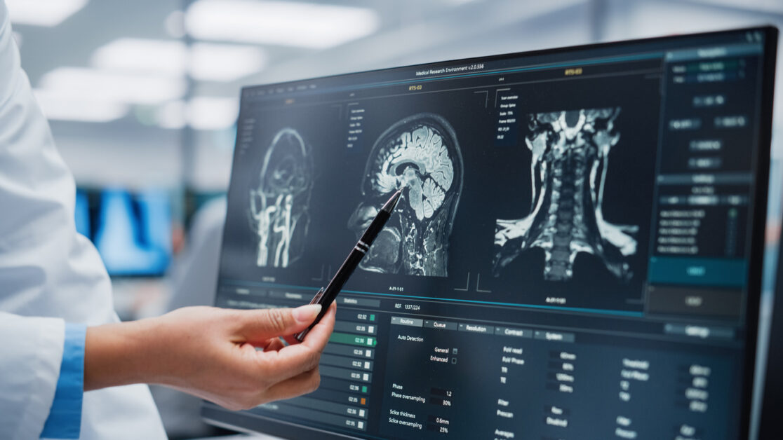 TBI After a Car Accident - Traumatic Brain Injury