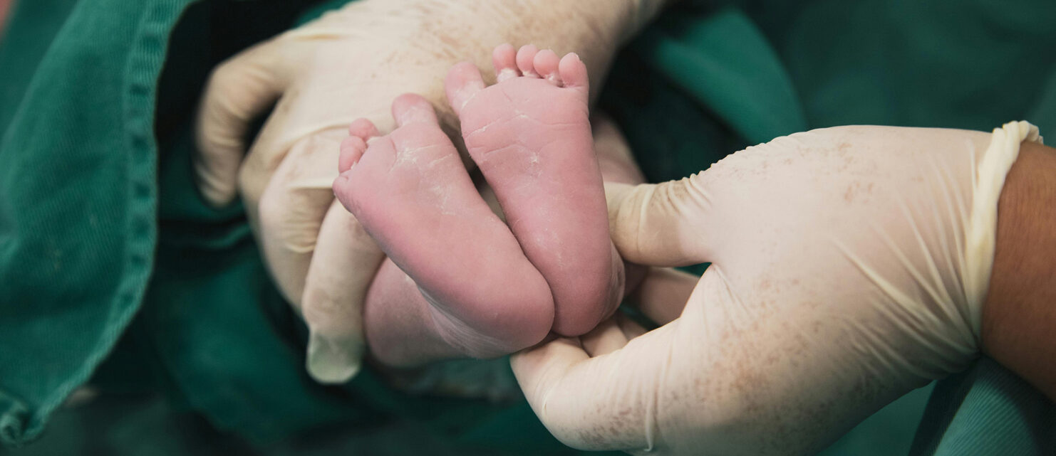 Doctor wearing surgical gloves gently holding a newborn’s feet in a delivery room, representing careful medical attention during childbirth.