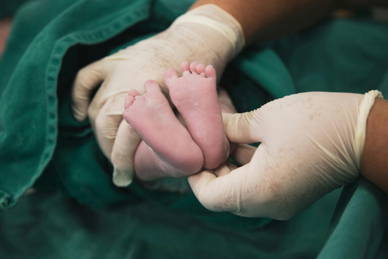 Doctor wearing surgical gloves gently holding a newborn’s feet in a delivery room, representing careful medical attention during childbirth.