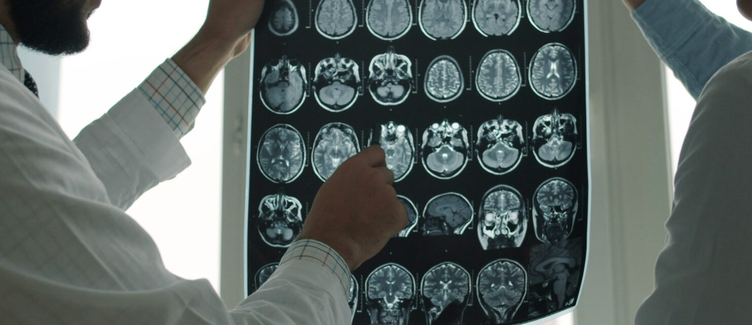 Two medical professionals examining multiple brain MRI scans for signs of traumatic brain injury.