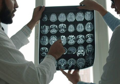 Two medical professionals examining multiple brain MRI scans for signs of traumatic brain injury.