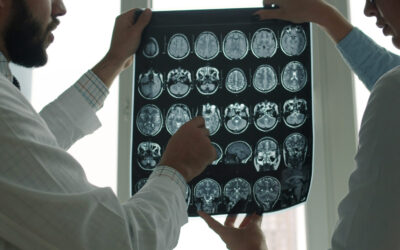 Two medical professionals examining multiple brain MRI scans for signs of traumatic brain injury.