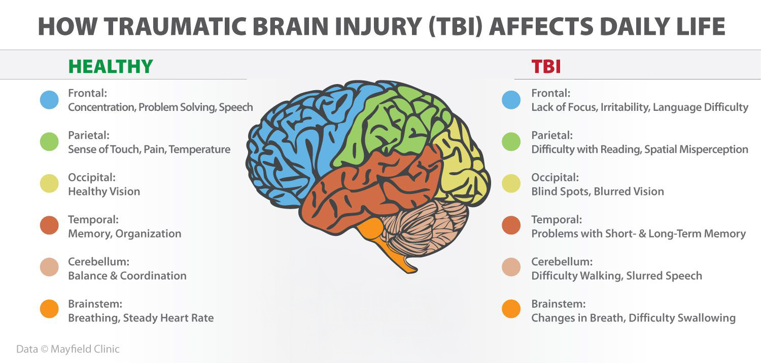 Diagram showing how traumatic brain injury affects different parts of the brain compared to a healthy brain, highlighting changes in focus, memory, coordination, and vision.