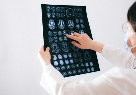 Doctor reviews brain imaging x-rays