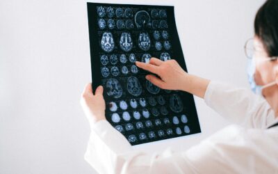 Doctor reviews brain imaging x-rays